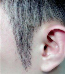 鬓角短少是什么原因？