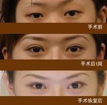 睫毛少不好看怎么办