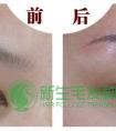 杭州眉毛种植技术好吗?