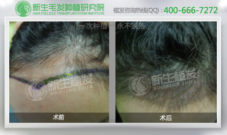 <a href=http://www.chinamaofa.com/meirenjianzz/ target=_blank class=infotextkey>美人尖</a>种植价格