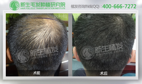 怎么选择一家好的<a href=http://www.chinamaofa.com/ target=_blank class=infotextkey>植发医院</a>?