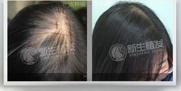 1bcf6bee7b23440628851ee2836163d2.jpg