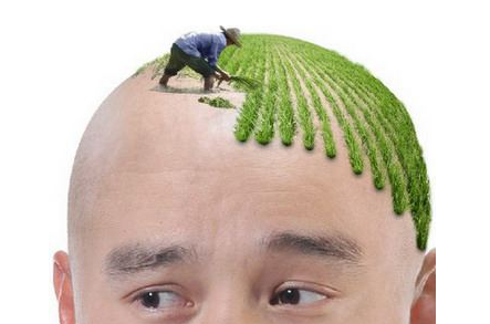头发种植
