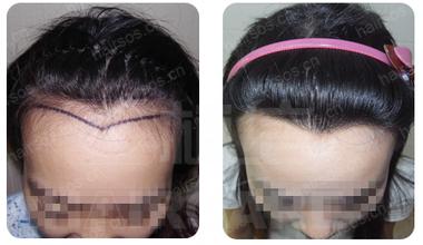 bcbc4688220a6ef837b27e283d26e790.jpg