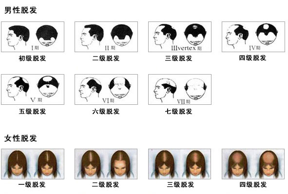 新生毛囊检测确定植发费用.jpg