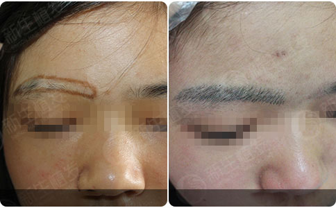 <a href=http://www.chinamaofa.com/zhifajiage/ target=_blank class=infotextkey>植发价格</a>为什么贵