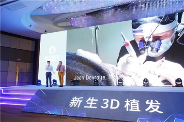 3D植发技术好在哪里