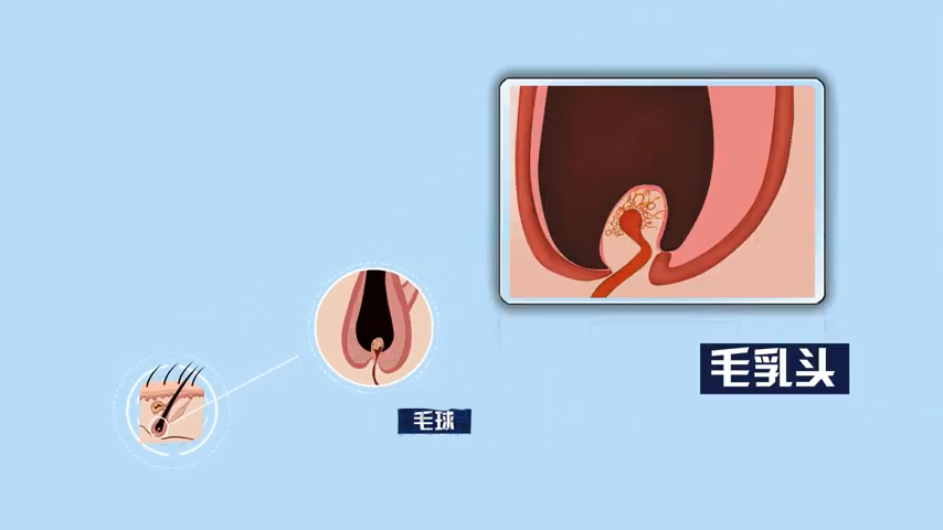 植发会产生后遗症吗?