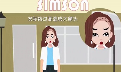 植发有哪些注意事项吗?
